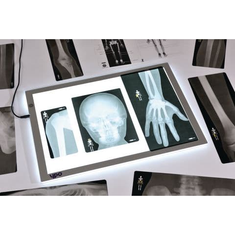 True To Life Human Bones X-Rays